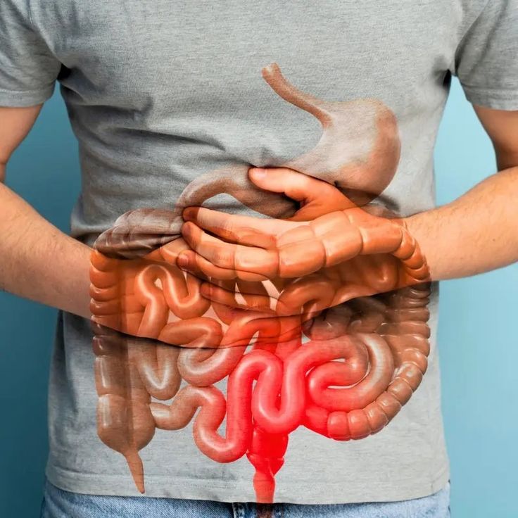 NUVEXA™️- GUT SUPPORT CAPSULE