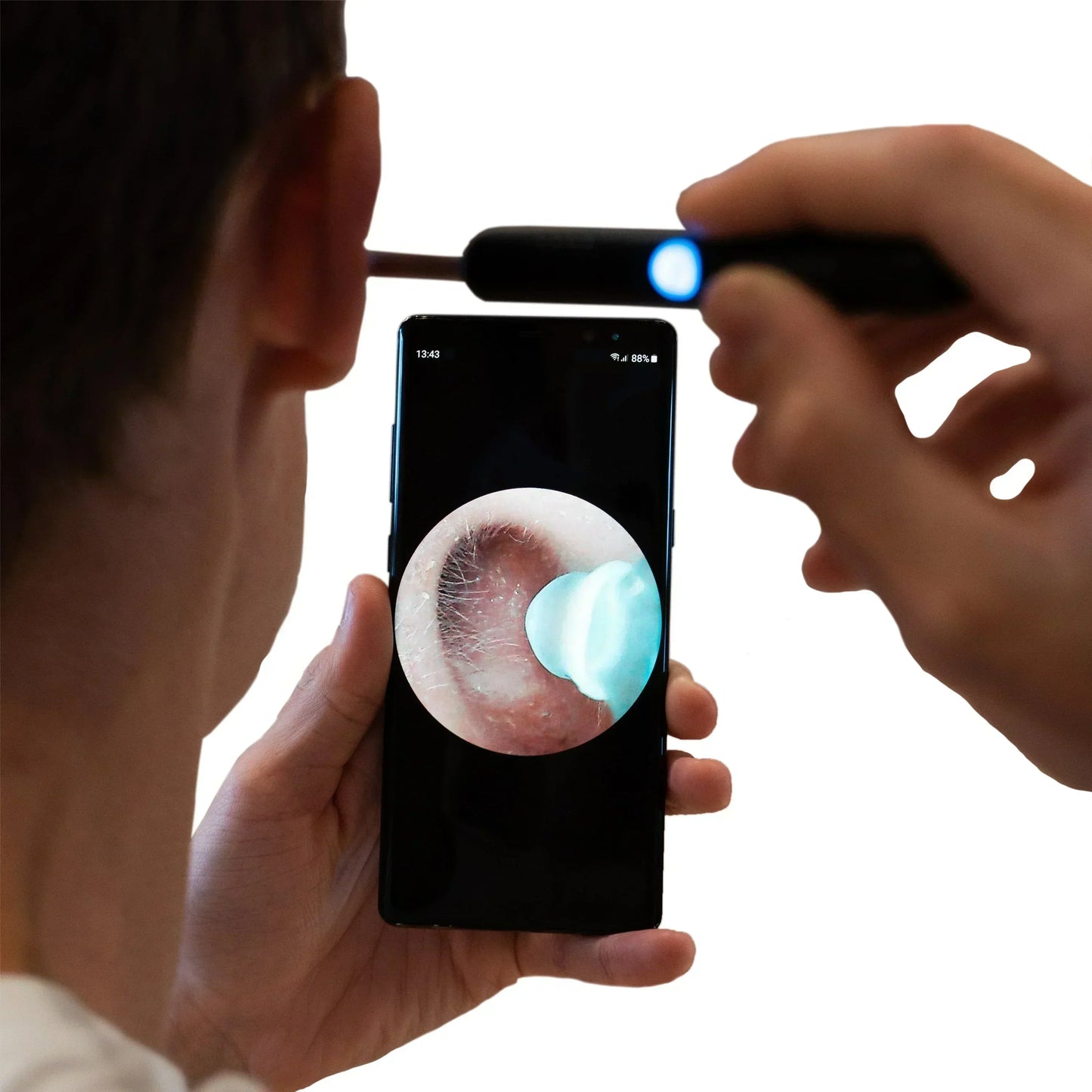 NUVEXA™️- PROFESSIONAL EAR WAX REMOVAL TOOL
