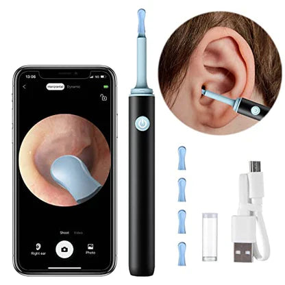 NUVEXA™️- PROFESSIONAL EAR WAX REMOVAL TOOL